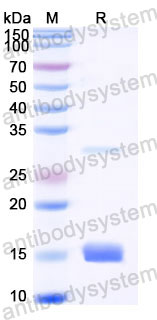 YHC38701, SDS-PAGE