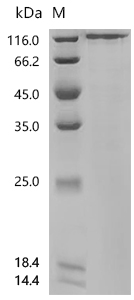 SDS-PAGE