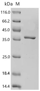 SDS-PAGE