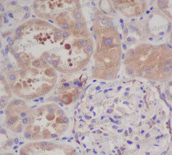 Валидация AntibodySystem RHE32002