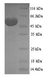 SDS-PAGE