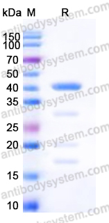 EHD66701, SDS-PAGE