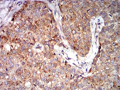 Валидация AntibodySystem RHF07502 (2453)