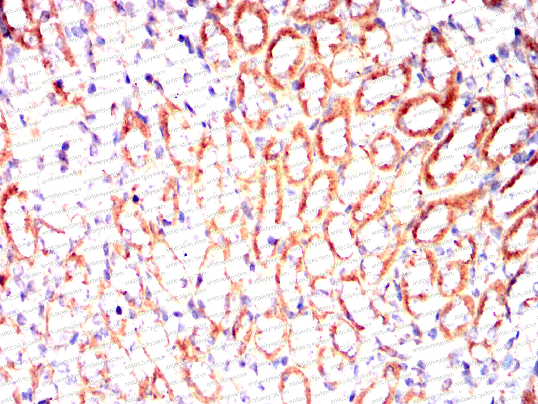 Валидация AntibodySystem RHC15302 (675)
