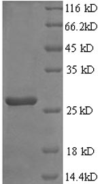 SDS-PAGE