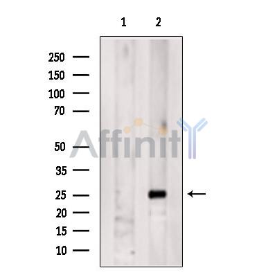 Валидация Affinity DF6742 - 18287