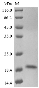 SDS-PAGE