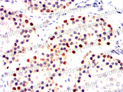 Валидация AntibodySystem RHE73903