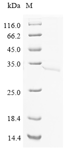 SDS-PAGE