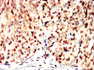 Валидация AntibodySystem RHB22802