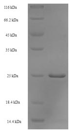 SDS-PAGE