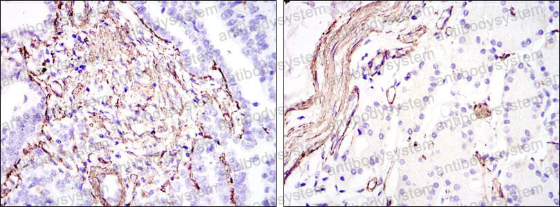 Валидация AntibodySystem RHF52702