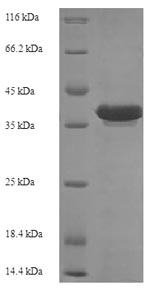 SDS-PAGE