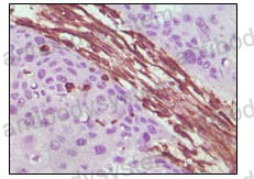 Валидация AntibodySystem RHC35310
