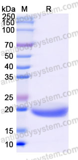 EHK32301, SDS-PAGE