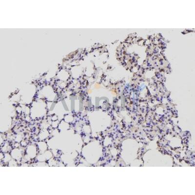 Валидация Affinity AF6421 - 3724