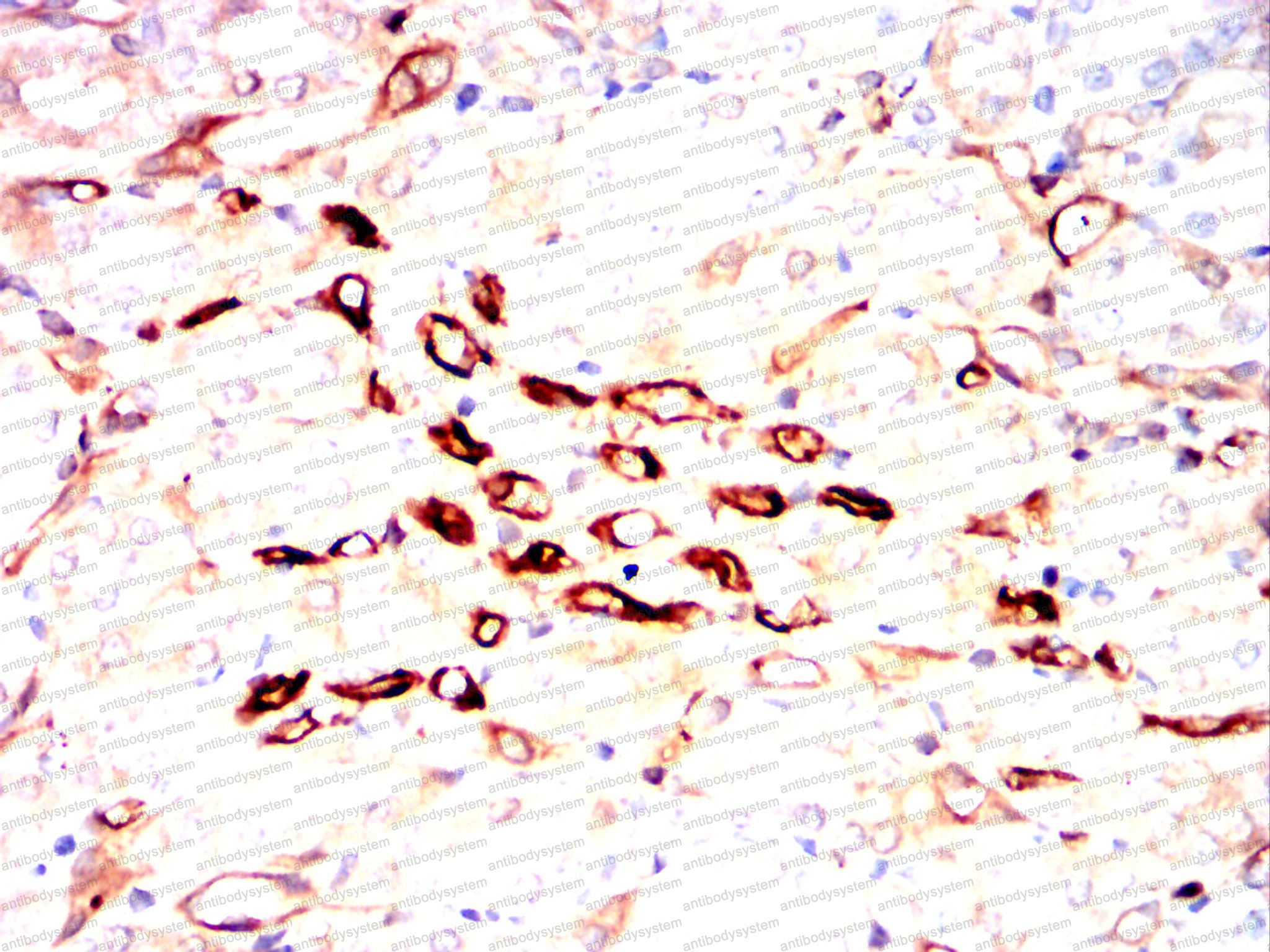 Валидация AntibodySystem RHJ73202