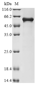 SDS-PAGE