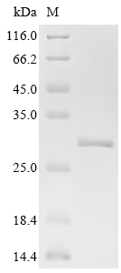 SDS-PAGE