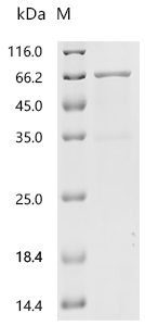 SDS-PAGE