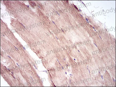 Валидация AntibodySystem RHK37401