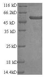 SDS-PAGE