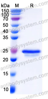 YHB97902, SDS-PAGE