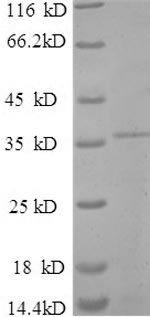 SDS-PAGE