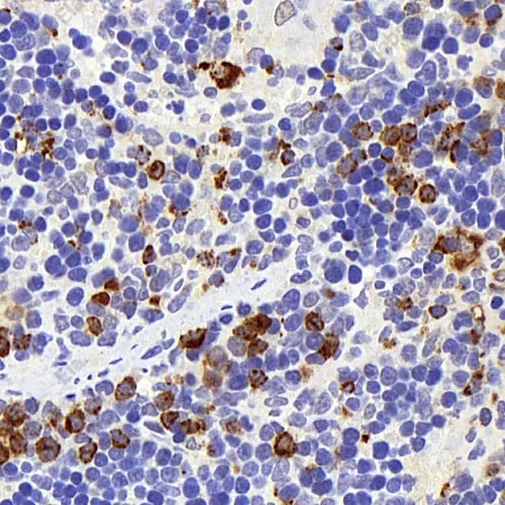 Иммуногистохимия, Lysozyme, ткань селезенки крысы