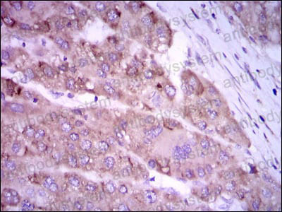 Валидация AntibodySystem RHE08001 (1956)