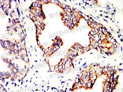 Валидация AntibodySystem RHN99202