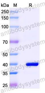 Валидация SDS-PAGE - AntibodySystem RVV23301