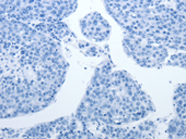 Валидация AssayVector ARM1120(336)