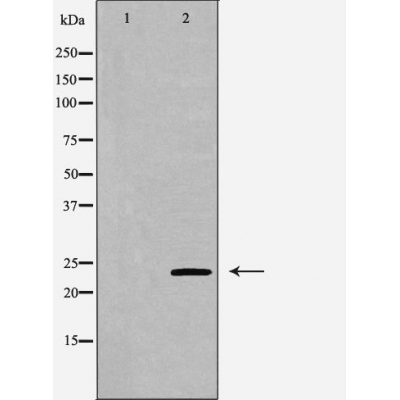 Валидация Affinity DF6104 - 17321
