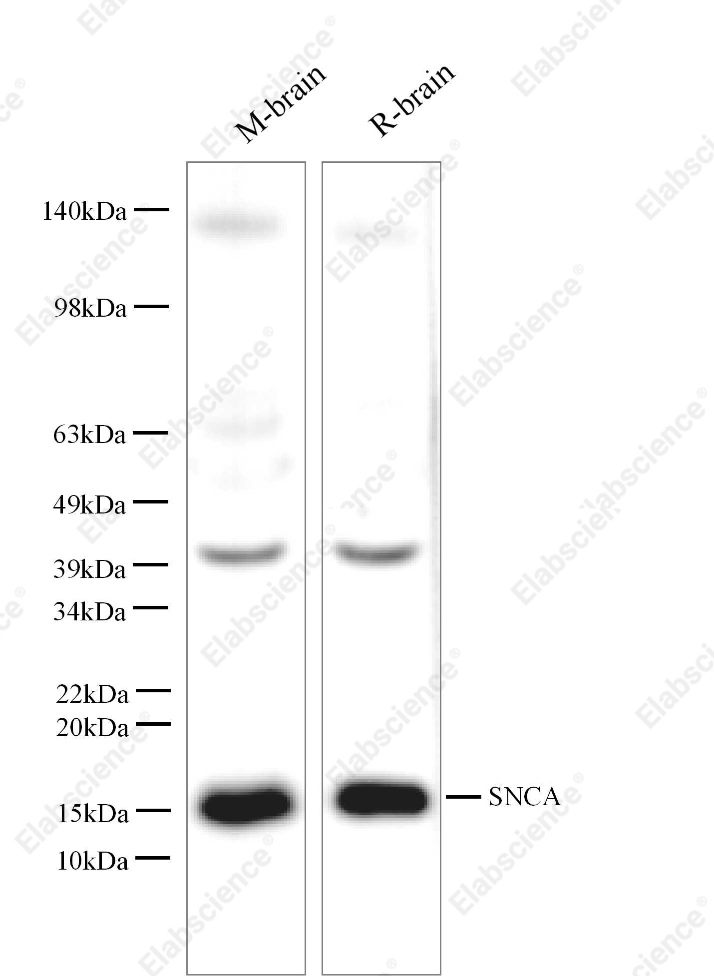 Вестерн-блоттинг, SNCA, клетки SH-SY5Y и ткань мозга
