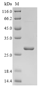 SDS-PAGE