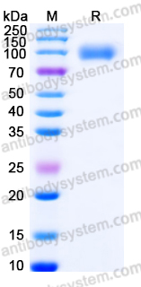 EHJ05101, SDS-PAGE