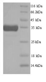 SDS-PAGE