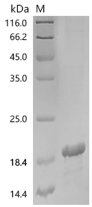 SDS-PAGE