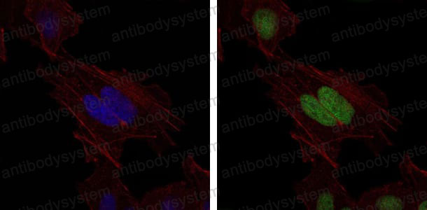 Валидация IF - AntibodySystem RHE93105
