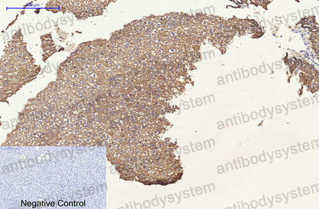 Валидация AntibodySystem RHC17905 (723)