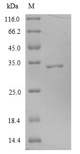 SDS-PAGE