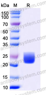 EHA14901, SDS-PAGE