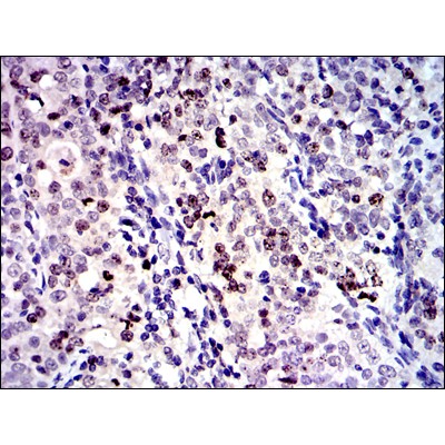 Валидация Affinity BF0652 - 5347