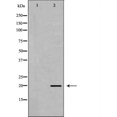 Валидация Affinity DF6530 - 17951