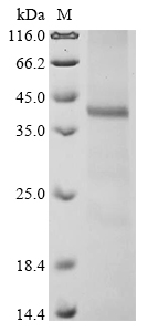 SDS-PAGE