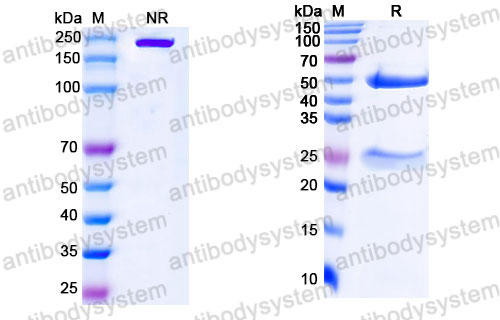 Валидация SDS-PAGE - AntibodySystem DHJ36102