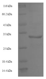 SDS-PAGE
