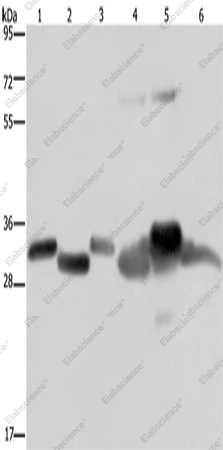 Вестерн-блоттинг, HMGCL, ткань тимуса мыши, ткань рака яичника человека, сердце мыши, печень плода человека, печень мыши и клетки SKOV3