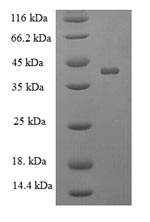 SDS-PAGE